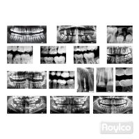 Rayos X Dental