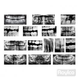 Rayos X Dental Rayos X Dental